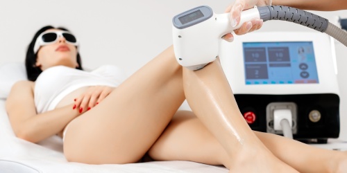 Épilation laser Marcq-en-Barœul