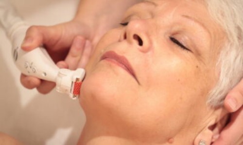 Robodermie visage près de Roubaix