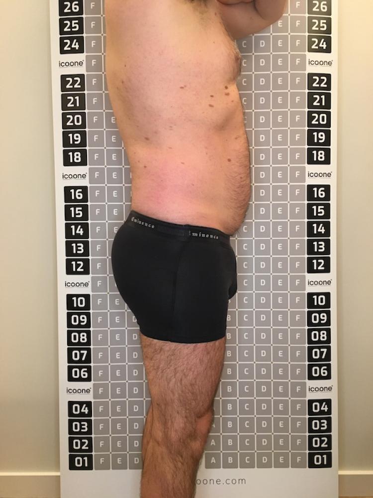 Après cure amincissante Lille