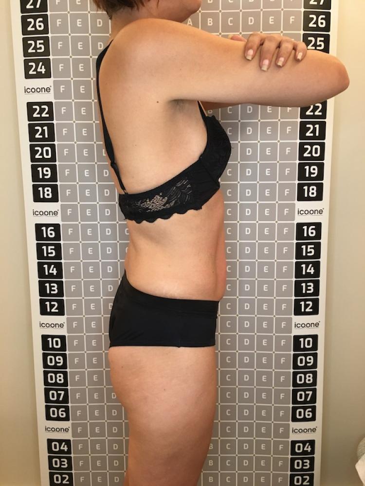 Après cure amincissante Lille