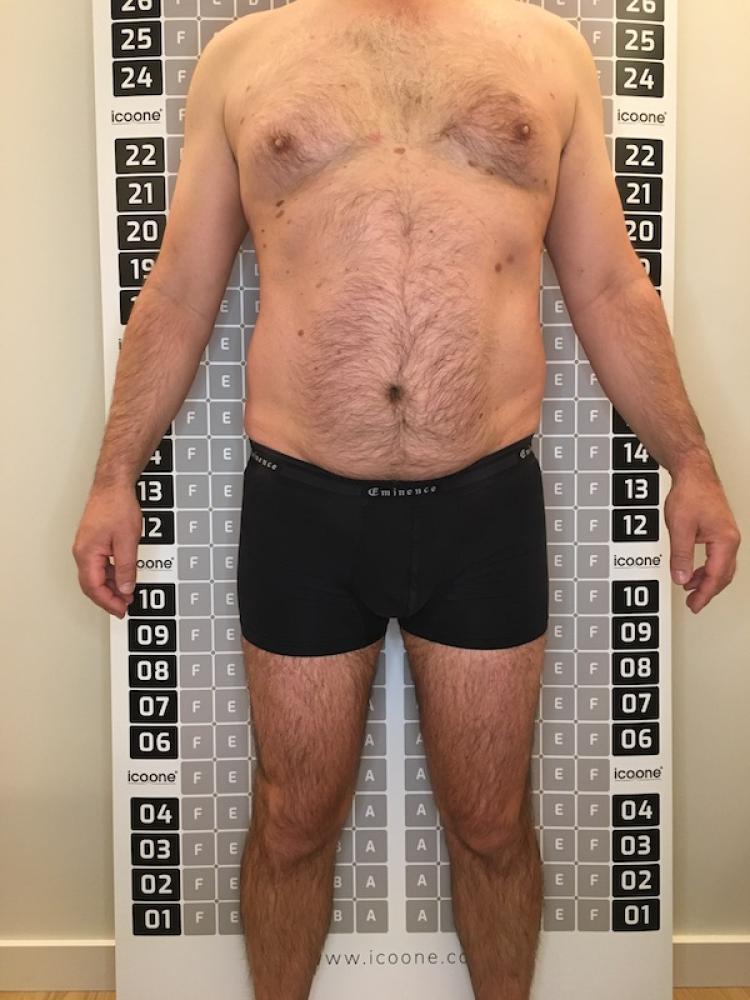 Après cure amincissante Lille